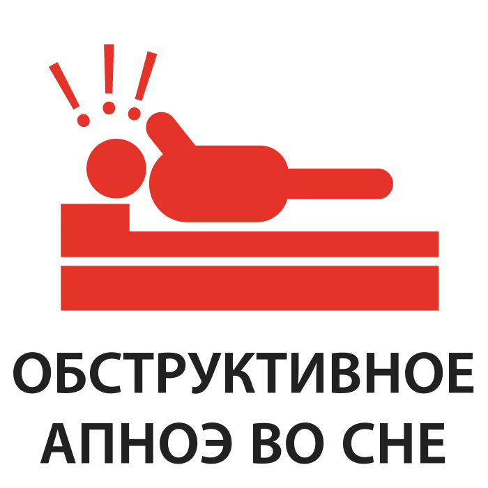 Обструктивное апноэ во сне