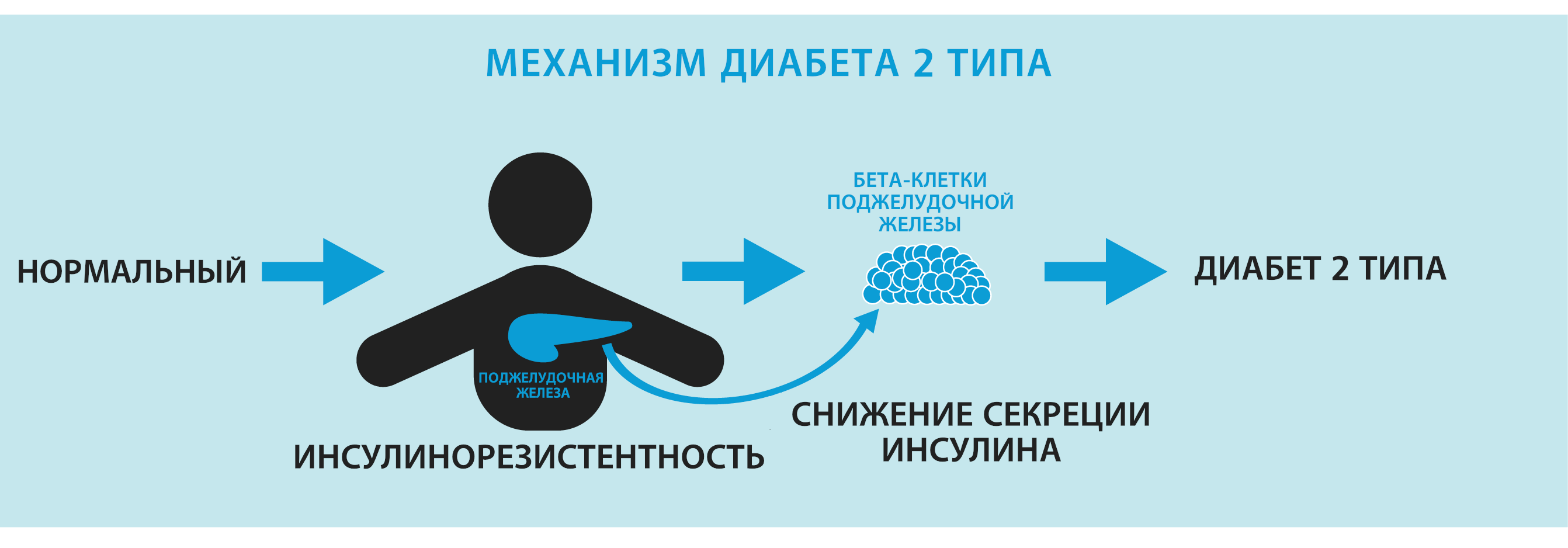Механизм диабета 2 типа
